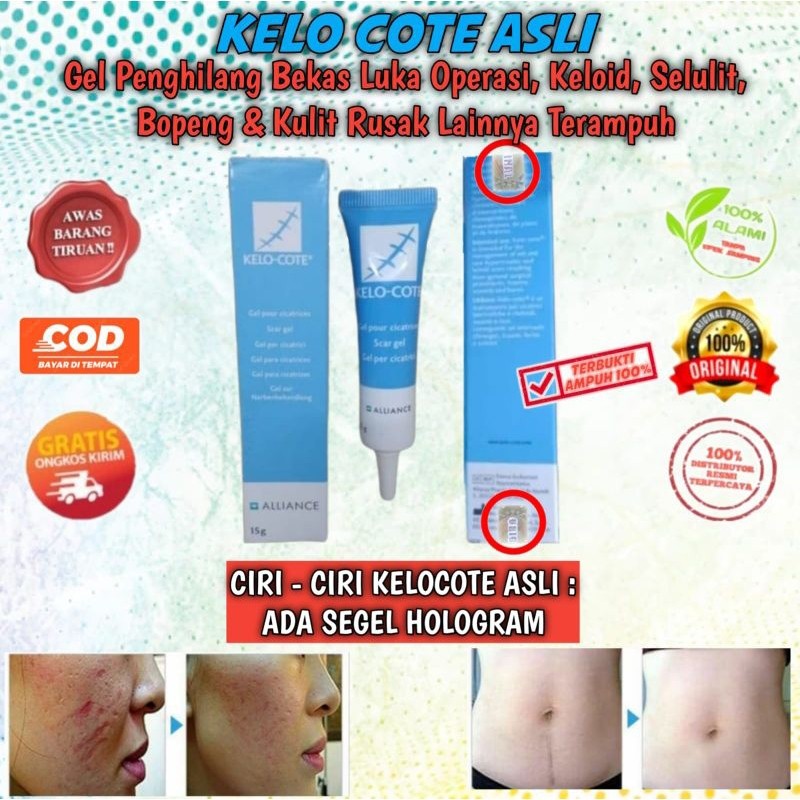 KELO COTE ORIGINAL GEL MENGHILANGKAN BEKAS LUKA, KELOID, BOPENG, SELULIT, SCARS & KULIT RUSAK TERAMP