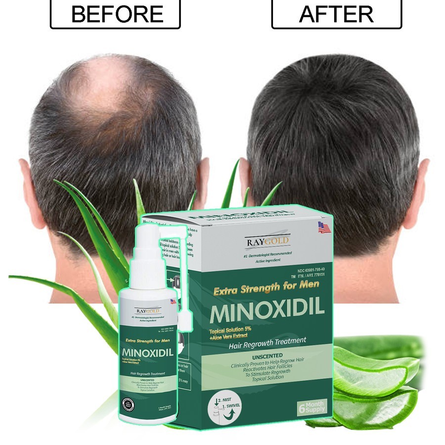 MINOXIDIL 5% penumbuh rambut & brewok with Aloe Vera for MEN made in USA - RAYGOLD - MINOX MINOKSIDI