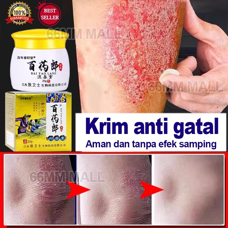 Salep Eksim Kering dan Gatal Salep Gatal China Paling Ampuh Obat Gatal Selangkangan Salep Bayi Untuk