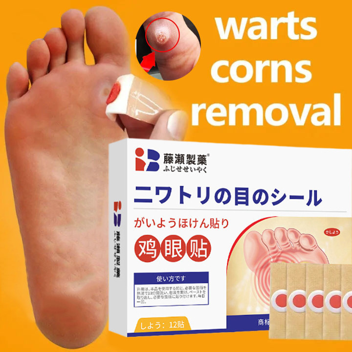 Koyo Kaki Ampuh Jepang Asli 12pcs Corn Patches Plester Penghilang Kutil Kapalan Mata Ikan Cepat Semb