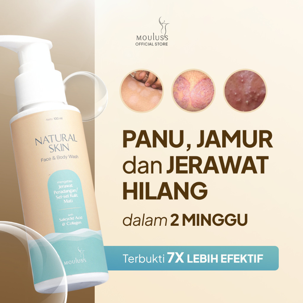Mouluss - 3x Efektif Mengatasi Panu & Jamur, Sabun Anti Panu, Sabun Jerawat Tubuh & Muka, Sabun Panu