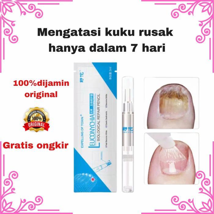 SERUM VITAMIN KUKU RUSAK OBAT SALEP JAMUR KUKU KAKI TANGAN CENTANGAN