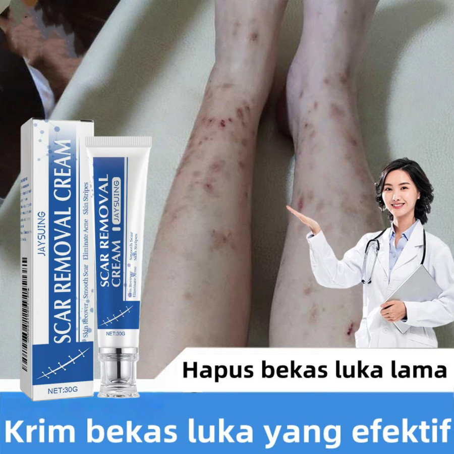 Penghilang bekas luka 30g hitam koreng Salep penghilang bekas luka Obat penghilang bekas luka Menghi