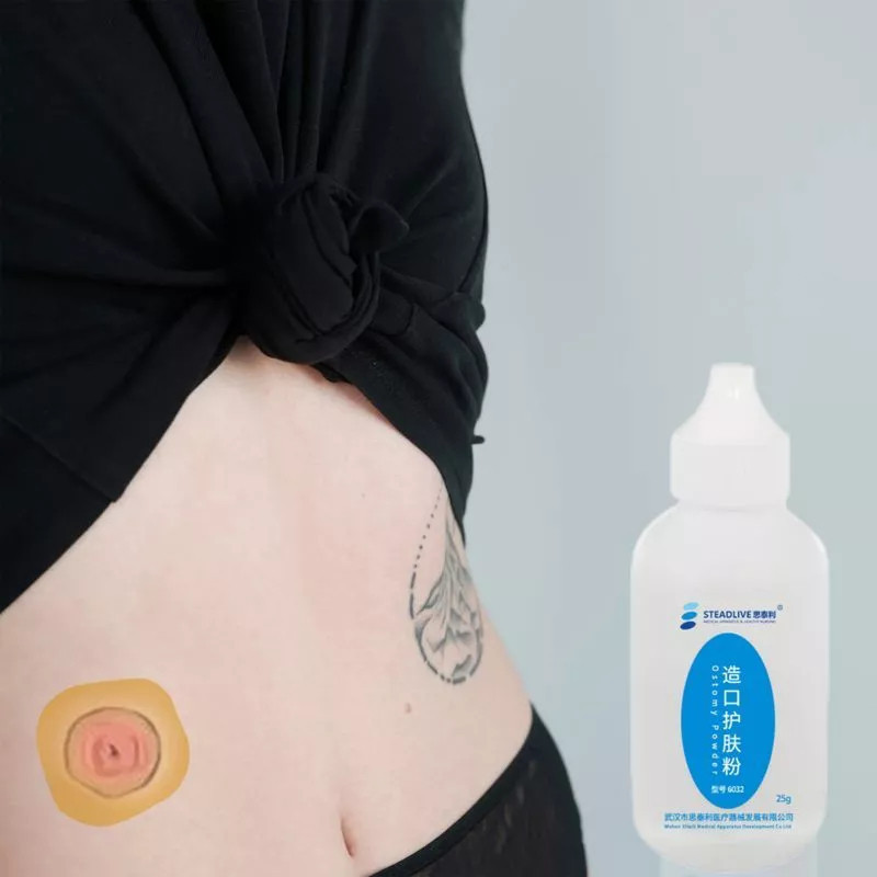 Steadlive Stoma Powder / Bedak Anti Iritasi Stoma Steadlive