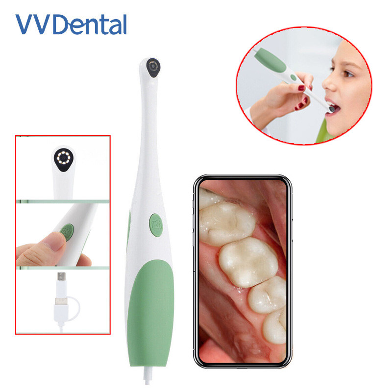 Kamera Oral Gigi 480P/1080P HD Kamera Pemeriksaan Intraoral Elektronik Mini 3 IN 1 Tipe-c USB Kamera
