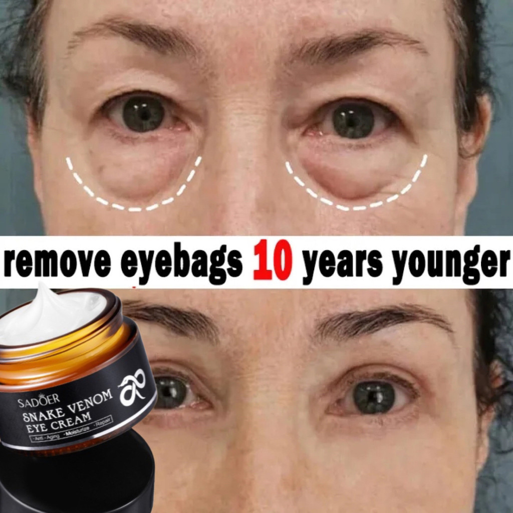 BS - SADOER eye cream/menghilangkan mata panda/penghilang kantung mata/eye cream mata panda/serum ma