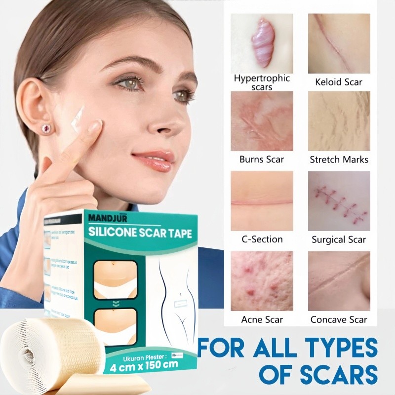 Keloid plester bekas luka keloid  Scar Removal Patch Salep Penghilang bekas luka Obat bekas luka Oba