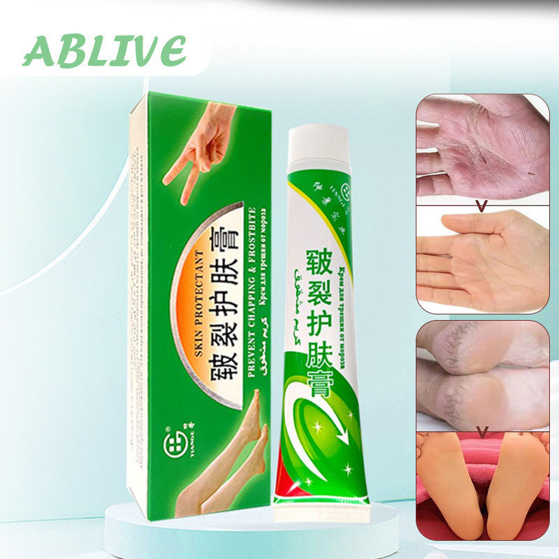Salep Krim Penghilang Gatal Jamur Kulit Kaki Obat Ampuh Tumit Pecah Pecah Kering Mengelupas 100% Ori