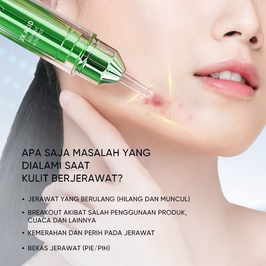 3X Acid Acne Spot Gel 11g - Obat Totol Jerawat, Samarkan Bekas & Dark Spot, Anti Acne, Salicylic Lac