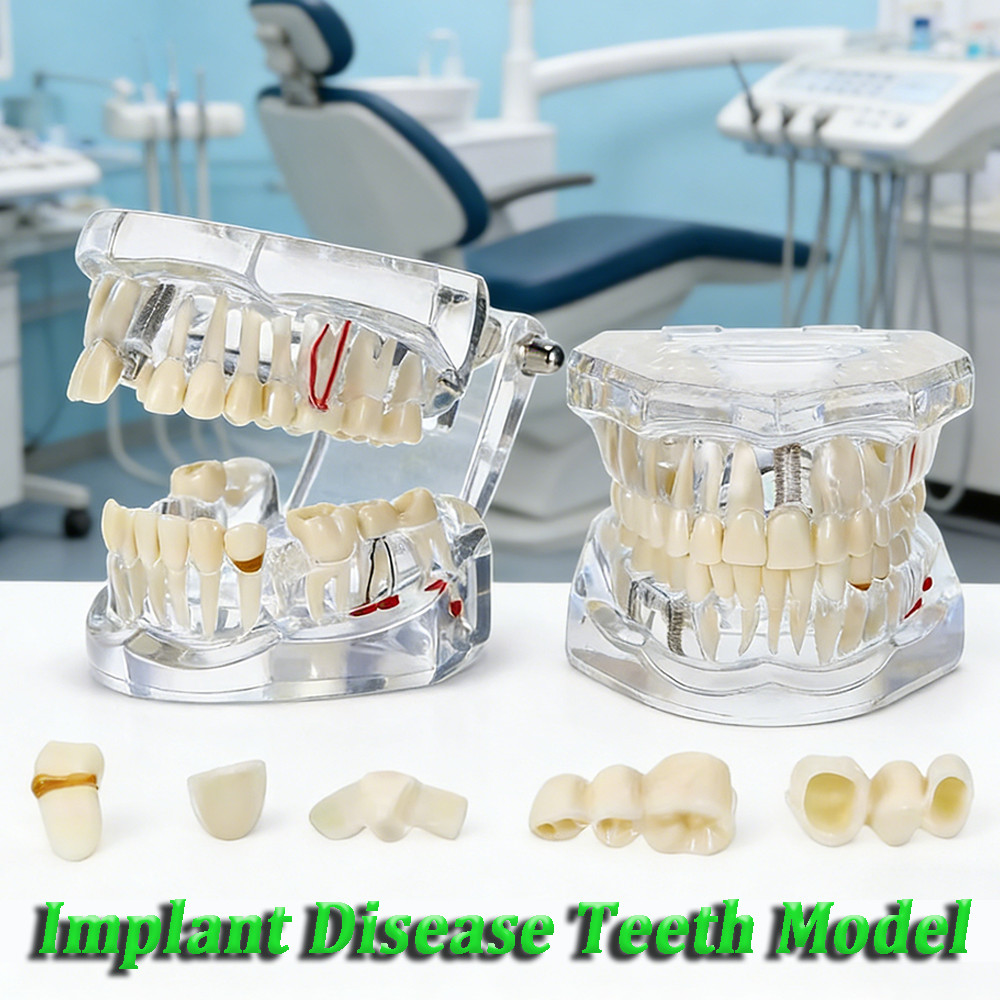 1pcs model gigi dental study model phantom gigi bisa di lepas model study gigi edukasi transparan st