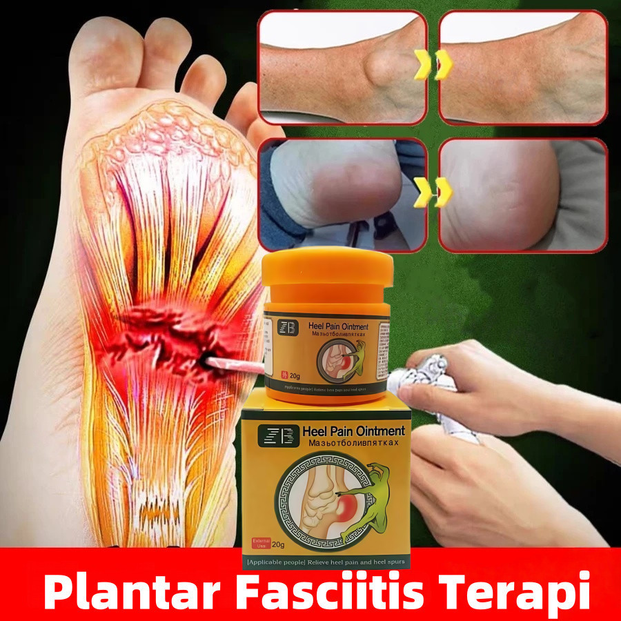 COD Salep Sakit Tumit Plantar Fasciitis Obat Nyeri Telapak Kaki Terapi Pereda Nyeri Keseleo Bengkak 
