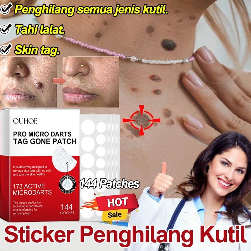 Wart Removal Patch Stiker Penghilang Kutil Dan Tahi Lalat Skin Tag Remover Patch Penghilang Kutil Di