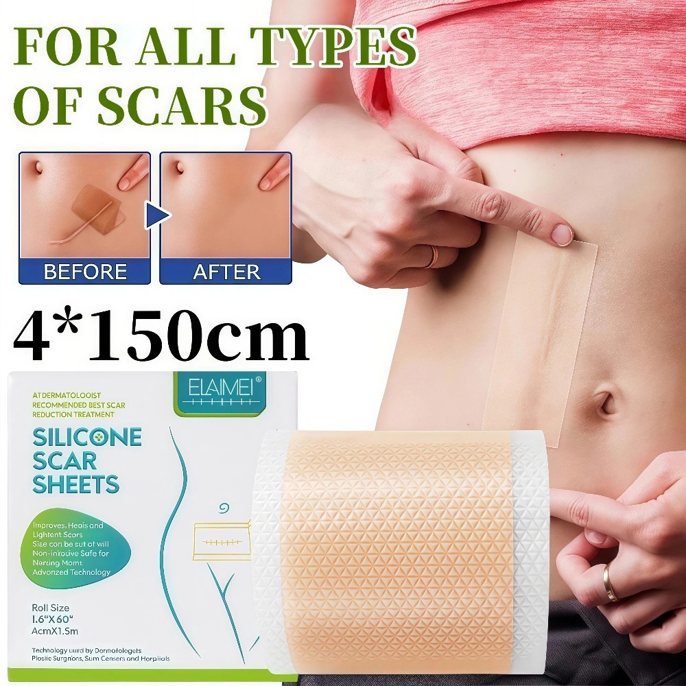 ELAIMEI  Silicone Keloid 1Roll Keloplast Silicone Keloid Plester Scar Tape Keloid Bekas Luka