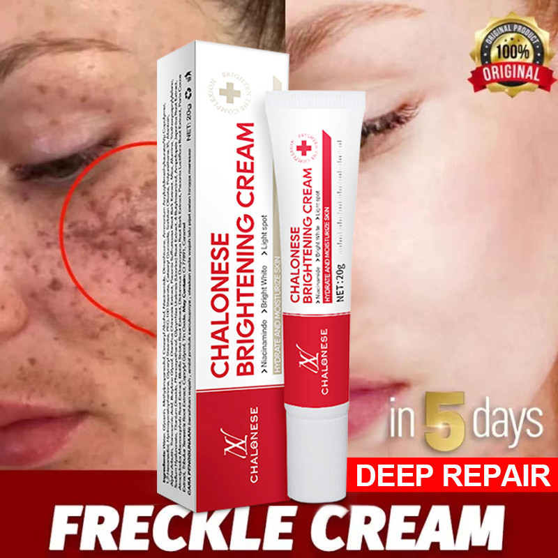 Chalonese BPOM Krim penghilang flek hitam Krim Dark spot removal cream 20g Niacinamide Whitening Cr
