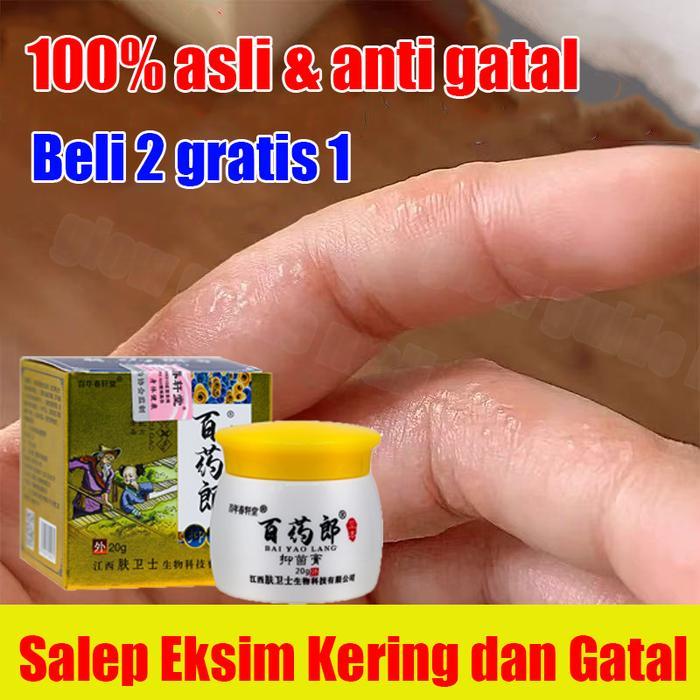 salep gatal kulit yang ampuh salep gatal bayi dan gatal selangkangan salep miss v gatal dan perih