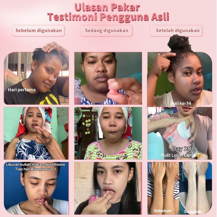 DISKON BIYODE HALAL FDA PLUS GLUTATHIONE 24H BIYODE GLUTATHIONE GUMMIES, BEAUTY GLUTATHIONE,