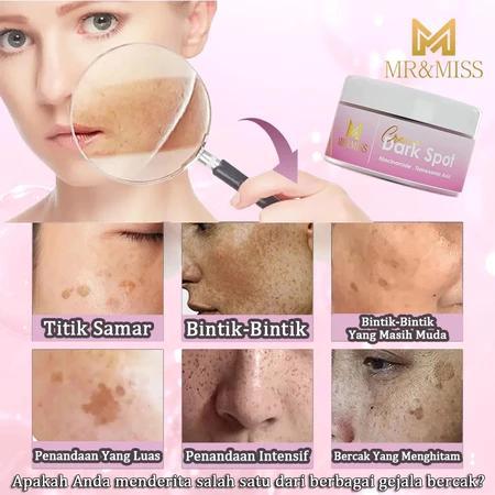 BPOMCream flek hitam membandel bpom salep flek hitam membandel cream penghilang flek hitam 30g serum