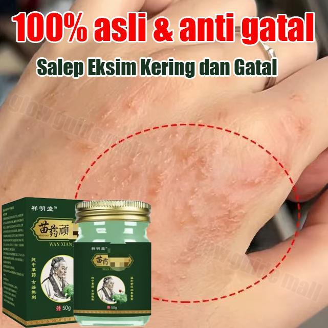 salep eksim kering dan gatal obat gatal selangkangan salep kurap jamur salep gatel kulit ampuh