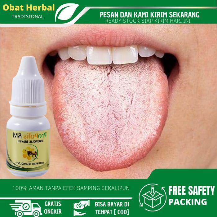 Cairan Tetes Pembersih Lidah Putih, Lidah Berjamur, Lidah Pecah Sariawan, Lidah Terasa Pahit, Lidah