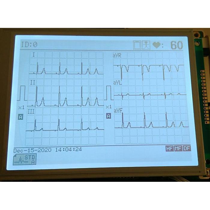 LCD UNTUK EKG FUKUDA DENSHI