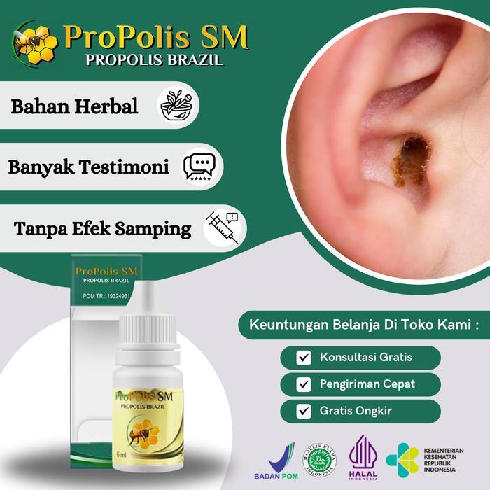 Cairan Tetes Kotoran Infeksi Telinga Cair Propolis Sm 100% Original Anak Dewasa