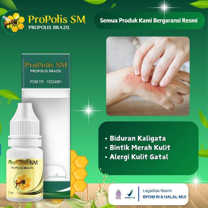 Salep Oles Untuk Biduran, Kaligata, Bintik Merah Kulit, Alergi Kulit Gatal, Psoriasis Dermatitis
