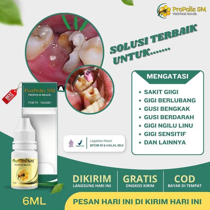 Propolis SM - Obat Tetes Sakit Gigi Herbal, Meredakan Sakit Gigi, Gigi Berlubang, dan Gusi Bengkak