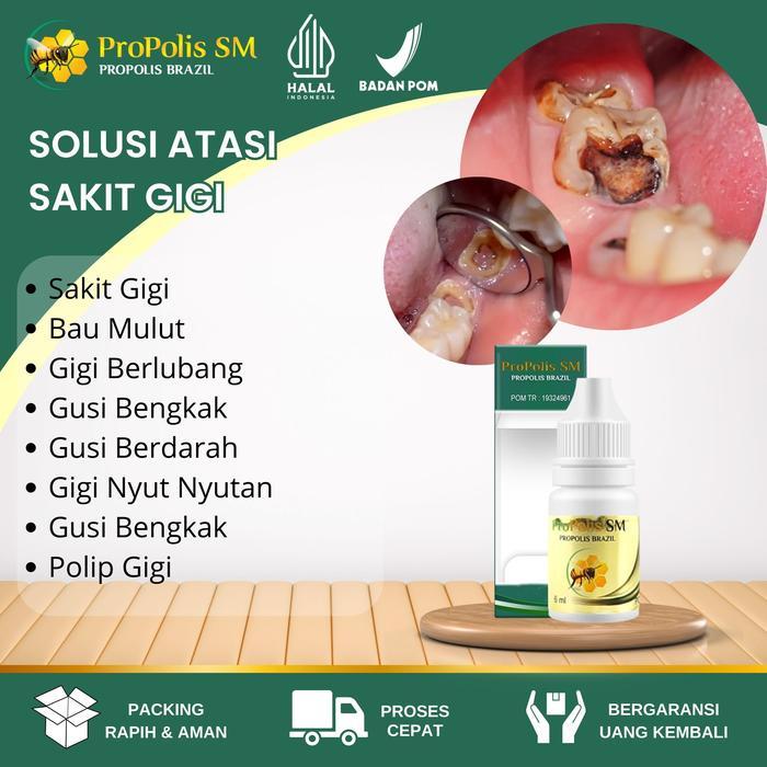 Propolis Sm Herbal Tetes Sakit Gigi Berlubang, Sakit Gigi, Sakit Gigi 6ml, Sakit Gusi, Gigi