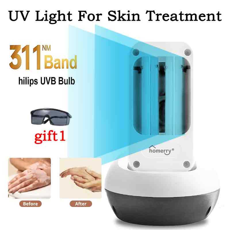 Ultraviolet phototherapy 311 nanometer narrowband UVB lamp, large-area UVb irradiation treatment for