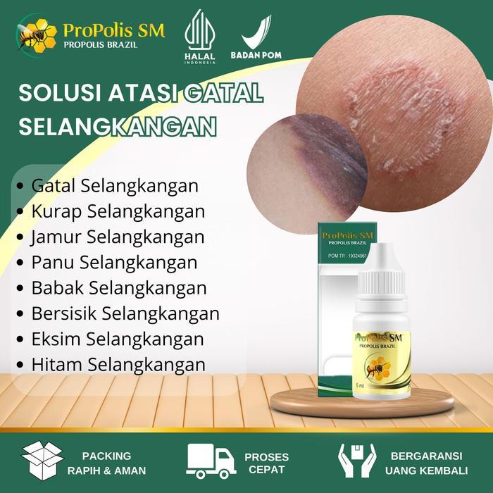 Selangkangan Hitam Dan Gatal, Selangkangan Berjamur, Salep Jamur Selangkangan Gatal, Exim