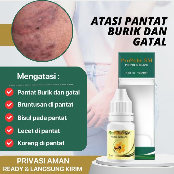 Pembersih Pantat Burik Dan G4Tal Penghilang Jerawat Bokong Bisul Pada Bokong Gatal Di Bokong Gatal