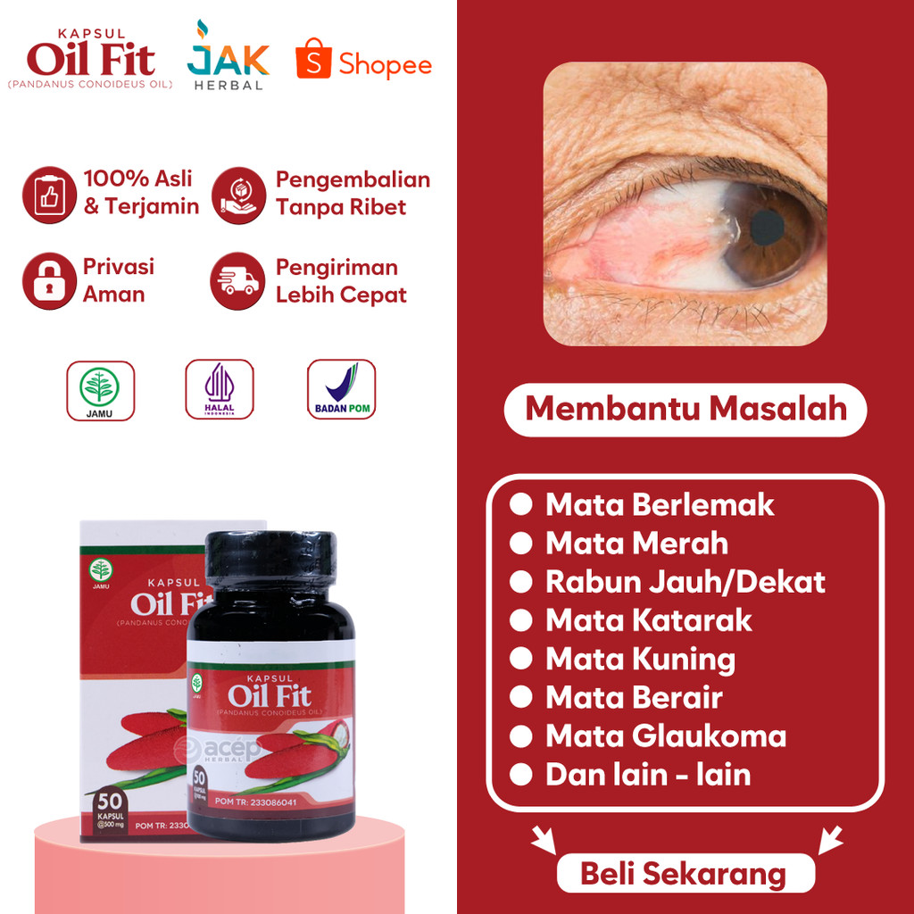 OilFit - Obat Mata Berlemak Penghilang Pterigium Tanpa Prosedur Medis Rumit