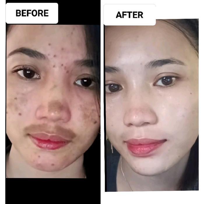 Js Skincare Ready Brigtening Night Cream Js Skincare Exclusive Krim Glowing/ Krim Flek Hitam/Krim