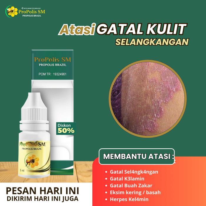 Salep Oles Untuk Gatal Seluruh Badan Pada Anak Dan Dewasa, Penghilang Gatal Selangkangan, Gatal