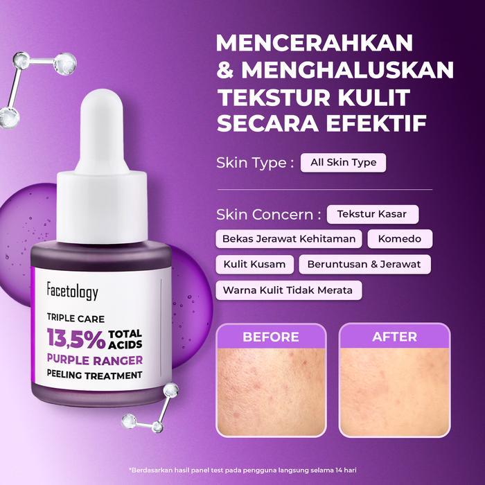 [New] Pre-Order Facetology Buy 4 Get 5 Paket Skincare Best Seller (Micellar, Serum, Moisturizer,