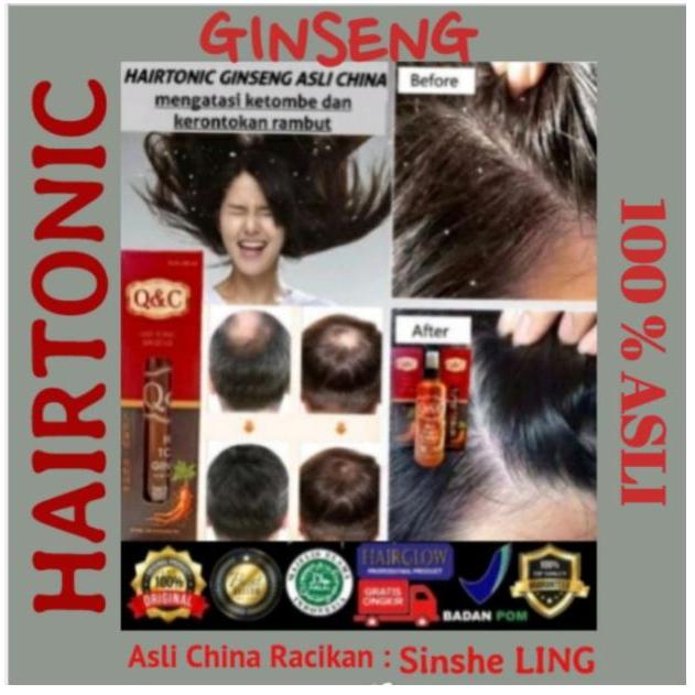 Q&C Hair Tonic / Hairtonic Obat Penyubur Penumbuh Rambut Rontok Minyak Perawatan Terbaru