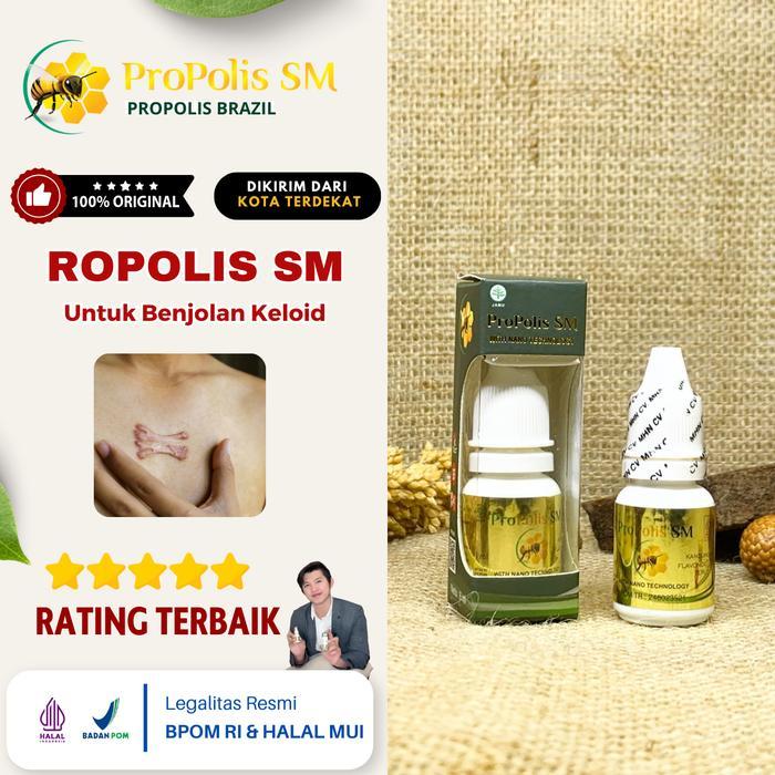 Propolis Sm Brazilian 6 Ml Solusi Keloid Herbal Di Dada Tangan Punggung & Injeksi Aman Efektif Bpom