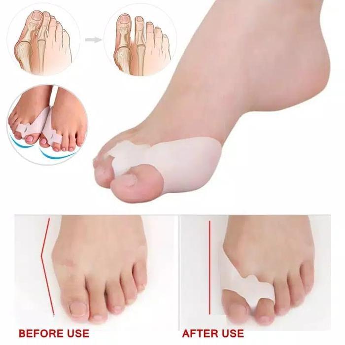INSOLE SEPATU PEMISAH JARI KAKI SILIKON KAKI WANITA SOL SEPATU WANITA GEL SILICON UNTUK JEMPOL