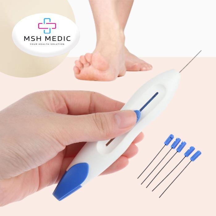 Sale Alat Test Kaki Diabetes Monofilamen Diagnostik