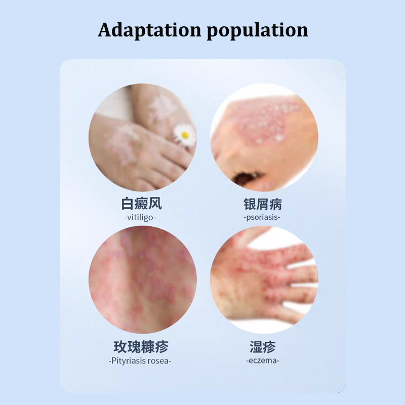 UVB 311NM Narrowband Ultraviolet Lamp Phototherapy Instrument Treatment Vitiligo Lamp for Psoriasis