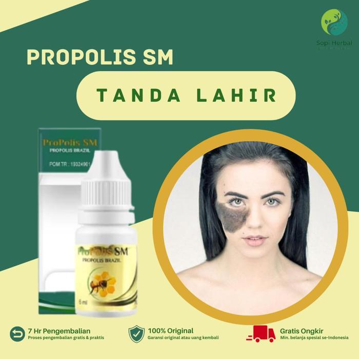 Penghilang Tanda Lahir, Tanda Lahir Coklat/Hitam, Memudarkan Tanda Lahir, Tanda Lahir Merah, Oles