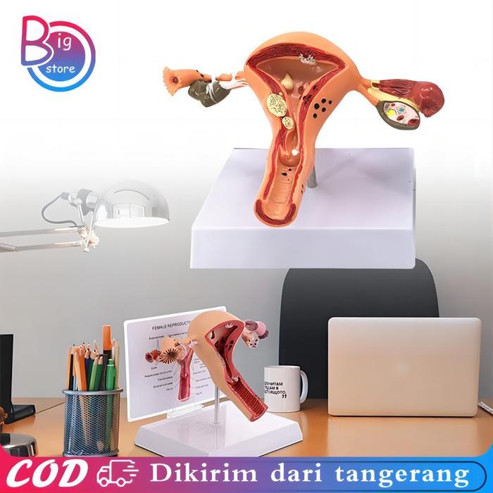 Uterus Ovary Anatomical Model Anatomy Alat Peraga Anatomi Model Patologis Uterus Ovarium Manekin