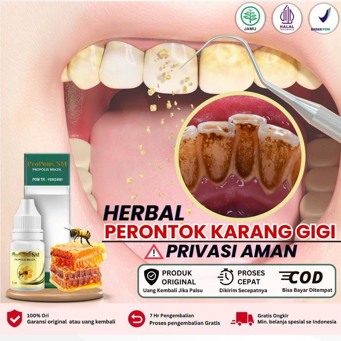 Penghilang Plak Gigi, Perontok Karang Gigi Membandel Sudah Bpom dan Halal 100% Terlaris Propolis