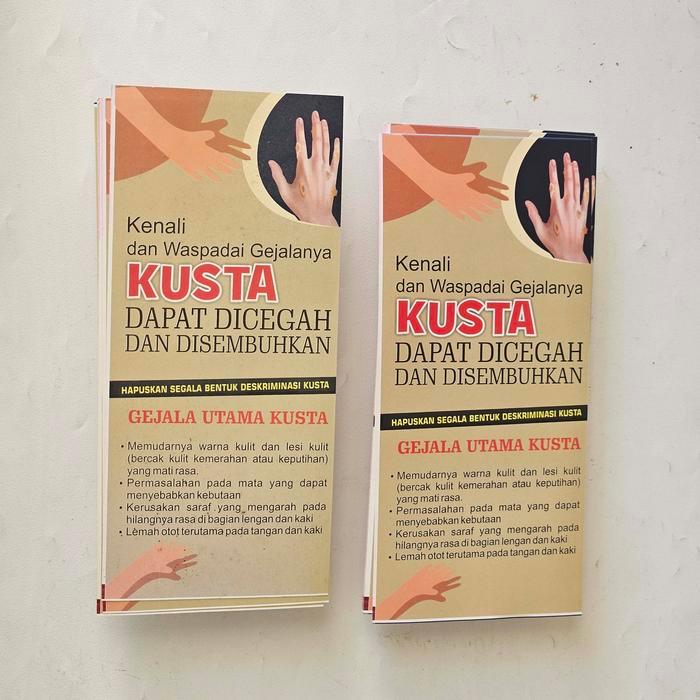 Flyer Kusta, Flyer Informasi Kesehatan Kusta, Lepra, Brosur Media Promkes