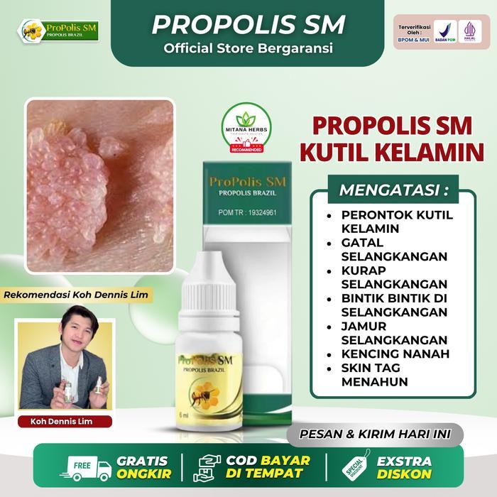 Propolis SM Perontok Kutil Kelamin, Gatal Selangkangan, Kurap Selangkangan, Bintik Bintik, Jamur