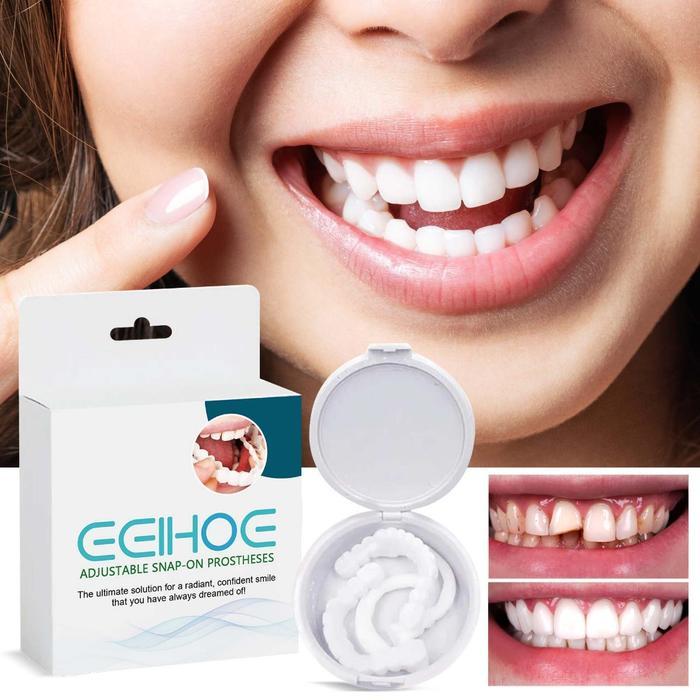 Gigi Palsu Instan-Adjustable Snap-On Prostheses Snap On Smile Gigi Palsu Instan Atas&Bawah 1set