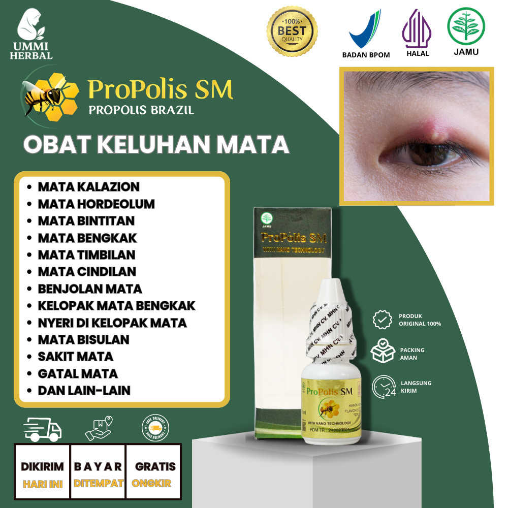 Obat Mata Benjolan Di Kantung Mata Bintitan Bengkak Kutil Di Kelopak Mata - PROPOLIS SM BRAZIL ASLI 