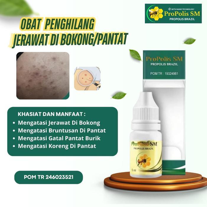 Propolis SM Obat Jerawat Bokong, Jerawat Pantat Bruntusan, Gatal Di Pantat, Salep Pantat Bruntusan,