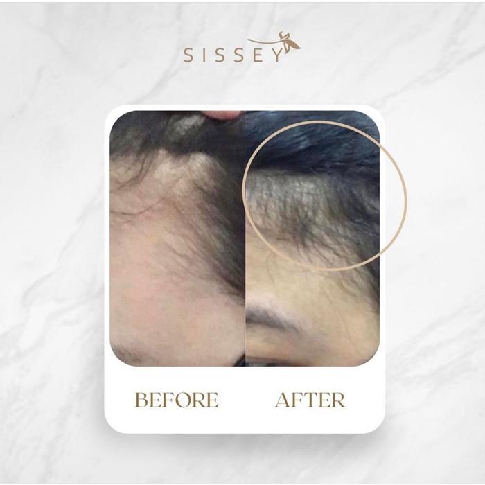 Sissey Hair Tonic