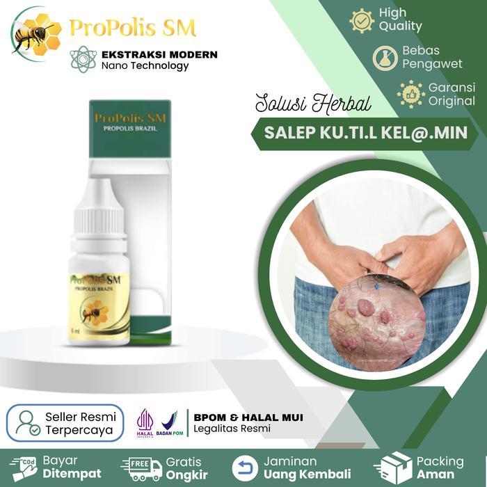 Propolis SM Brazil - Herbal untuk KUTIL Di Leher Tangan Jari Kaki Kutil Kelamin Papiloma Kondiloma